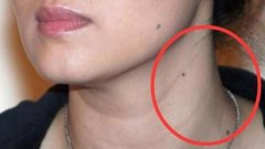 女人脖子左侧有痣代表什么