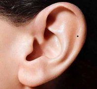 耳朵前面有痣代表什么