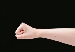 手臂上长痣代表什么 手臂痣相图解